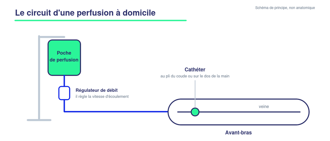 Schéma du circuit d'une perfusion à domicile : une poche de perfusion suspendue à une potence, reliée par une tubulure à un régulateur de débit, puis à un cathéter posé au pli du coude ou sur le dos de la main.